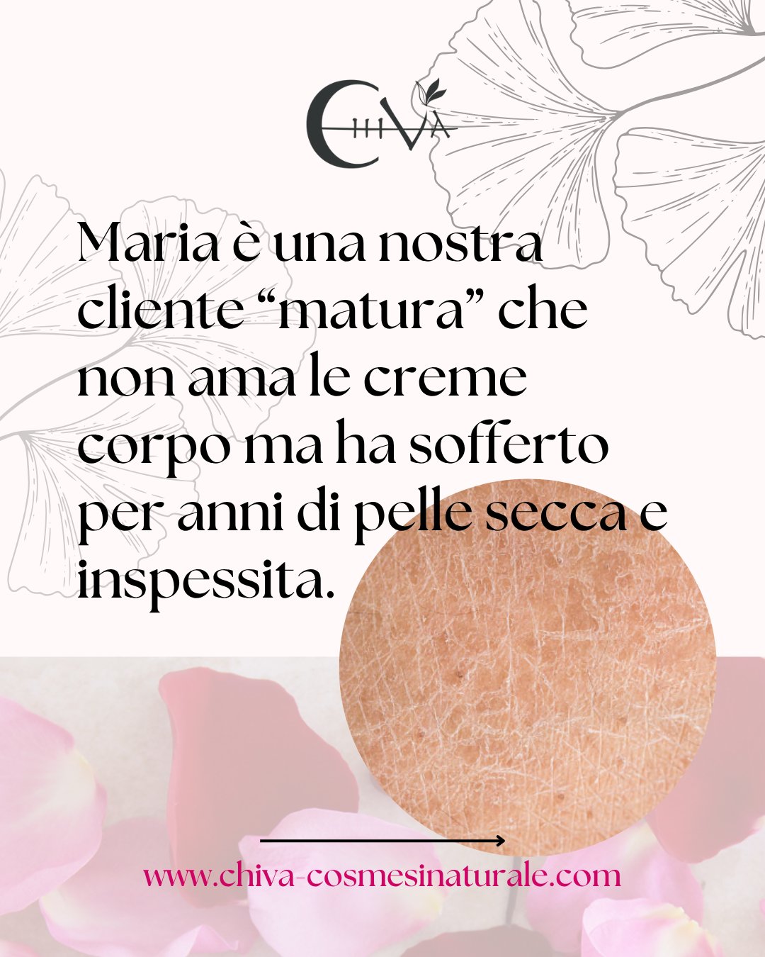 CHIVA PELLE SECCA